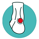 Bóle stawów skokowych