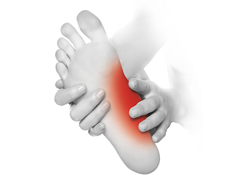 Wpływ płaskostopia podłużnego na bieganie