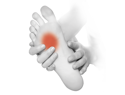 Wpływ płaskostopia poprzecznego na bieganie