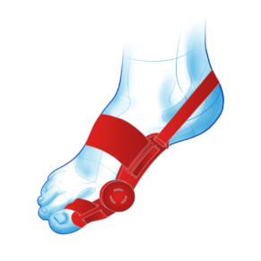 Hallux Remedium aparat korekcyjny na haluks