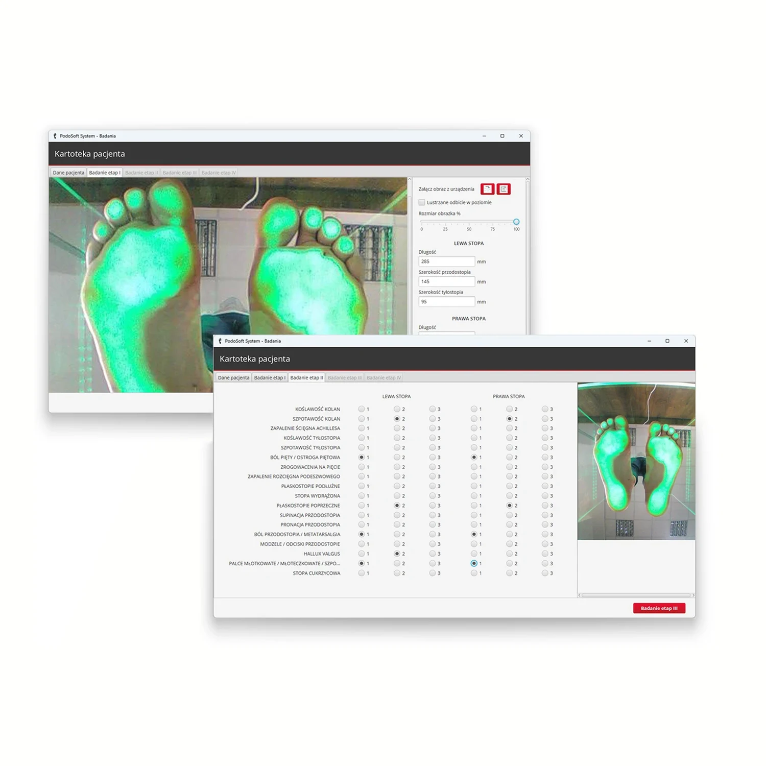 PodoSoft MAZBIT zaawansowane oprogramowanie do badania stóp Podoskop diagnostyczny do badania stóp PODOSCOPE 4K